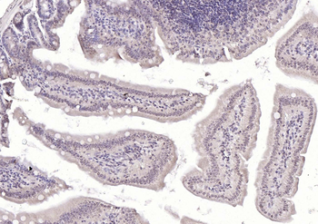 RAD9 Rabbit Polyclonal Antibody