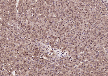 RAD9 Rabbit Polyclonal Antibody