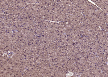 RAD9 Rabbit Polyclonal Antibody