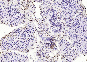 RAD9 Rabbit Polyclonal Antibody