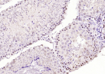 RAD9 Rabbit Polyclonal Antibody