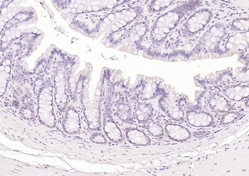 RAD9 Rabbit Polyclonal Antibody