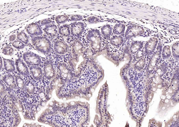 RAD9 Rabbit Polyclonal Antibody