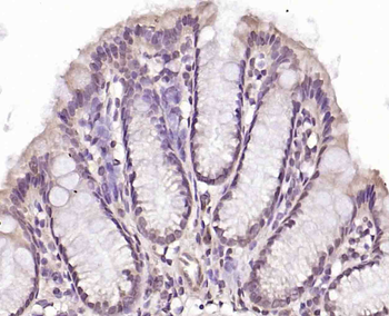 Phospho-RAD9 (Tyr28) Rabbit Polyclonal Antibody
