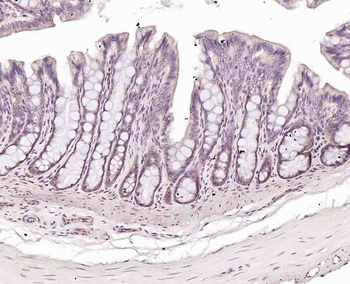 Phospho-RAD9 (Tyr28) Rabbit Polyclonal Antibody