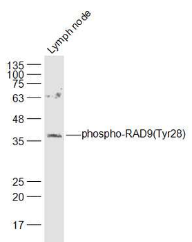 Phospho-RAD9 (Tyr28) Rabbit Polyclonal Antibody