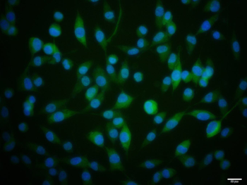 Phospho-RAD51 (Thr309) Rabbit Polyclonal Antibody