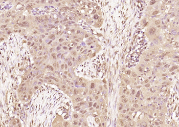 Phospho-RAD51 (Thr309) Rabbit Polyclonal Antibody