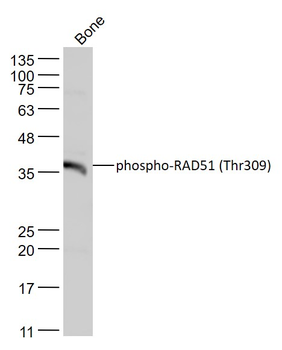 Phospho-RAD51 (Thr309) Rabbit Polyclonal Antibody