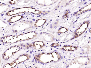 MUC1 Rabbit Polyclonal Antibody