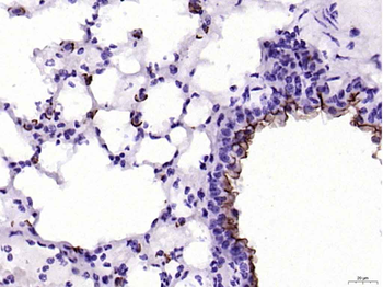 MUC1 Rabbit Polyclonal Antibody