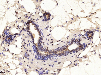 MUC1 Rabbit Polyclonal Antibody