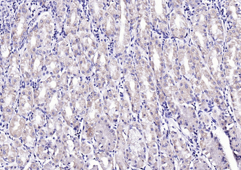 Phospho-CaMK2 alpha (Tyr230) Rabbit Polyclonal Antibody