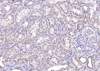 Phospho-CaMK2 alpha (Tyr230) Rabbit Polyclonal Antibody