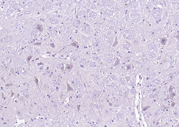 Phospho-CaMK2 alpha (Tyr230) Rabbit Polyclonal Antibody