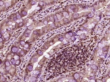 Phospho-Beta catenin (Tyr86) Rabbit Polyclonal Antibody