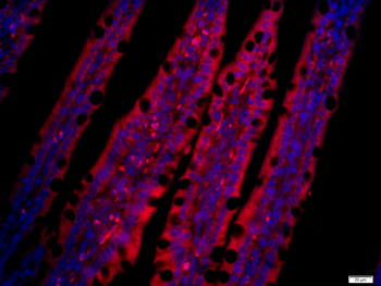 CCL25 Rabbit Polyclonal Antibody