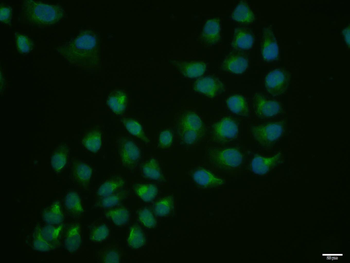 TRAK1 Rabbit Polyclonal Antibody