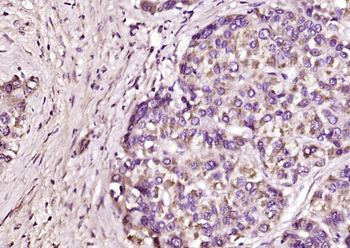 TRAK1 Rabbit Polyclonal Antibody