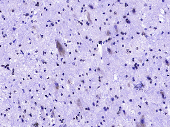 Phospho-c-Kit (Tyr721) Rabbit Polyclonal Antibody