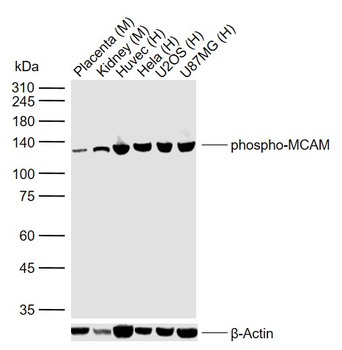 Phospho-MCAM (Tyr641) Rabbit Polyclonal Antibody