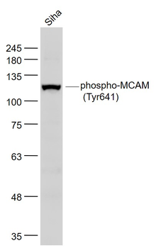 Phospho-MCAM (Tyr641) Rabbit Polyclonal Antibody