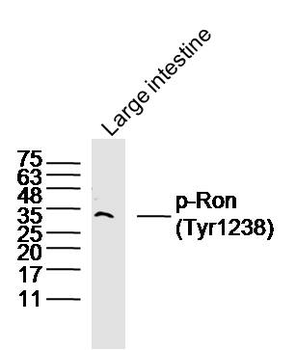 Phospho-Ron (Tyr1238) Rabbit Polyclonal Antibody