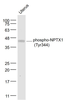 Phospho-NPTX1 (Tyr344) Rabbit Polyclonal Antibody