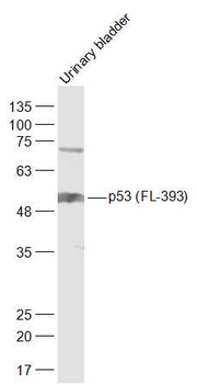 P53 (FL-393) Rabbit Polyclonal Antibody (HRP)