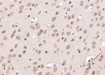 Bcr Rabbit Polyclonal Antibody