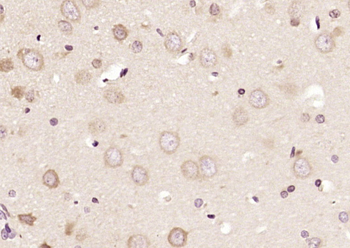 Bcr Rabbit Polyclonal Antibody