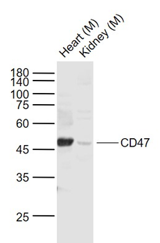 CD47 Rabbit Polyclonal Antibody