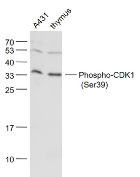 Phospho-CDK1 (Ser39) Rabbit Polyclonal Antibody