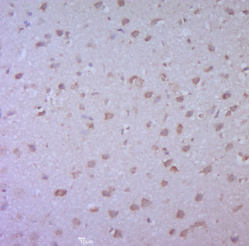 Cdc25B Rabbit Polyclonal Antibody