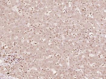 Phospho-CDK6 (Tyr13) Rabbit Polyclonal Antibody