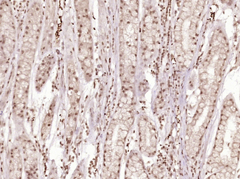 Phospho-CDK6 (Tyr13) Rabbit Polyclonal Antibody