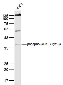 Phospho-CDK6 (Tyr13) Rabbit Polyclonal Antibody
