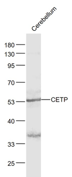 CETP Rabbit Polyclonal Antibody