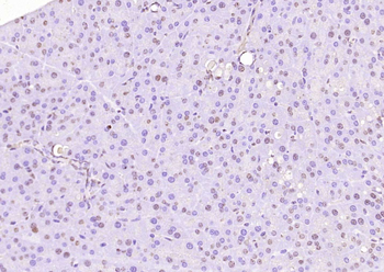 Phospho-HER4 (Tyr1188) Rabbit Polyclonal Antibody