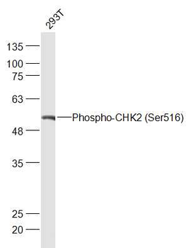 Phospho-CHEK2 (Ser516) Rabbit Polyclonal Antibody