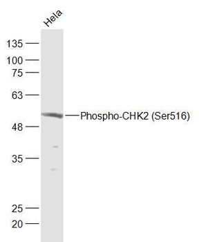 Phospho-CHEK2 (Ser516) Rabbit Polyclonal Antibody