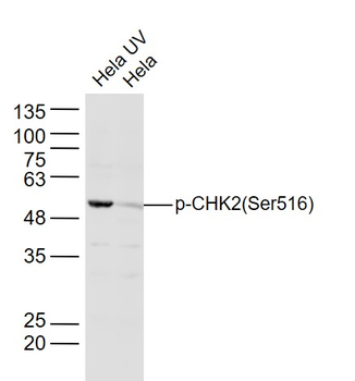 Phospho-CHEK2 (Ser516) Rabbit Polyclonal Antibody