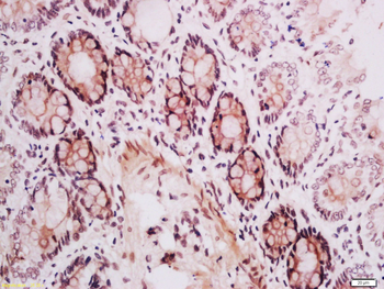 WBSCR14 Rabbit Polyclonal Antibody