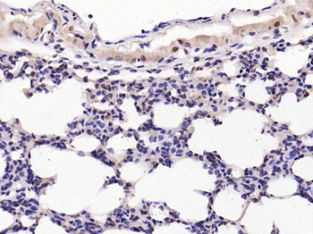 Phospho-c-Jun (Ser63) Rabbit Polyclonal Antibody