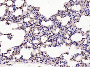 Phospho-c-Jun (Ser63) Rabbit Polyclonal Antibody