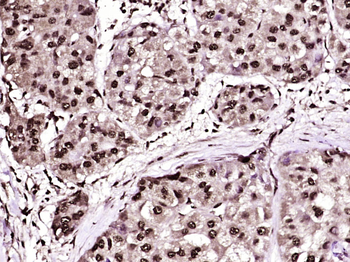 Phospho-CK18 (Ser60) Rabbit Polyclonal Antibody