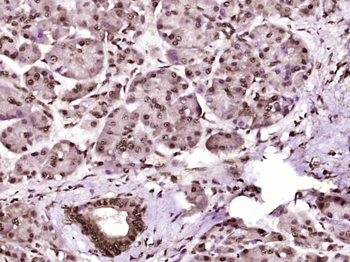 Phospho-CK18 (Ser60) Rabbit Polyclonal Antibody