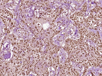 Phospho-CK18 (Ser60) Rabbit Polyclonal Antibody