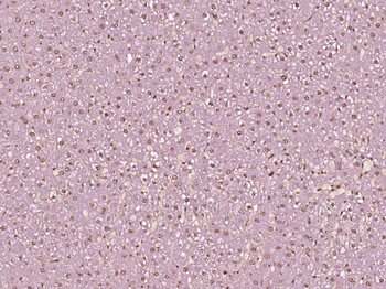 Phospho-CK18 (Ser60) Rabbit Polyclonal Antibody