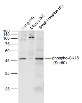 Phospho-CK18 (Ser60) Rabbit Polyclonal Antibody